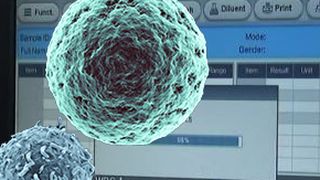 VIDEO | Testul care depistează cancerul în trei ore