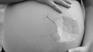 Două femei ginecolog, condamnate &icirc;n Germania de &rdquo;publicitate&rdquo; a avortului, &icirc;n pofida unei reforme recente &icirc;n domeniu