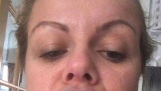 A fost la un pas de tragedie, după ce și-a injectat buzele. Ce a descoperit femeia la scurt timp de la intervenție 