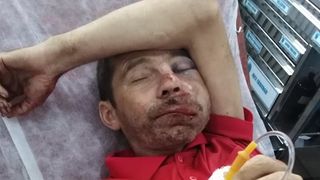 Bărbat din D&acirc;mboviţa, desfigurat de doi copii de 13 ani foarte periculoşi