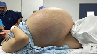 Medicii credeau că este gravidă și au vrut să-i facă cezariană! Ce au descoperit este halucinant