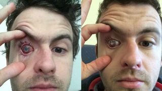 El este fotbalistul care a orbit pentru că i-a intrat un parazit &icirc;n cornee &icirc;n timp ce făcea duș