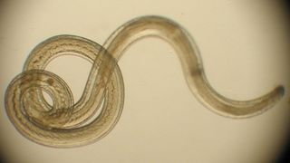 Semne clare că ai corpul plin de paraziţi. Nu le mai ignora niciodată!