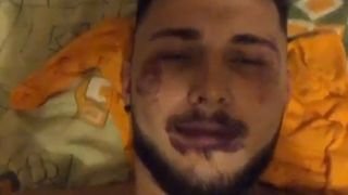 Alex Zănoagă, plin de v&acirc;nătăi! Fanii au rămas șocați! Ce a pățit fostul concurent de la Puterea Dragostei