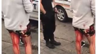 Scandalos! Fată de 14 ani din Galați, plină de sânge, ignorată de polițiști - IMAGINI ȘOCANTE