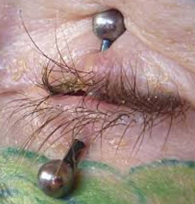 Și-a făcut un tatuaj și a ajuns de urgență la spital, la un pas de a-și pierde vederea