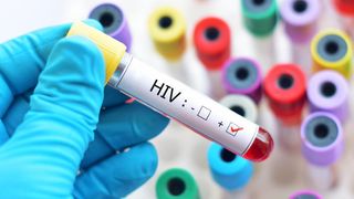 Alertă &icirc;n Arad! Un t&acirc;năr este acuzat că a infectat intenţionat cu HIV mai multe fete