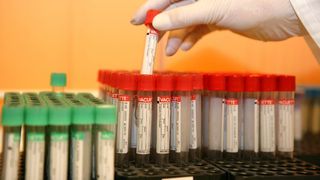 Alertă de HIV! Un t&acirc;năr a infectat intenționat mai multe fete cu acest virus