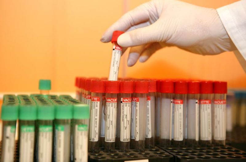 Alertă de HIV! Un tânăr a infectat intenționat mai multe fete cu acest virus