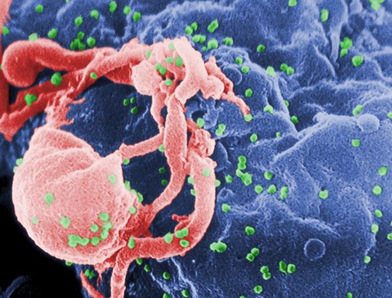 Alertă de HIV! Un tânăr a infectat intenționat mai multe fete cu acest virus