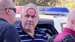 Indiciu uluitor pe fruntea lui Gheorghe Dincă. Fotografia care face furori pe internet