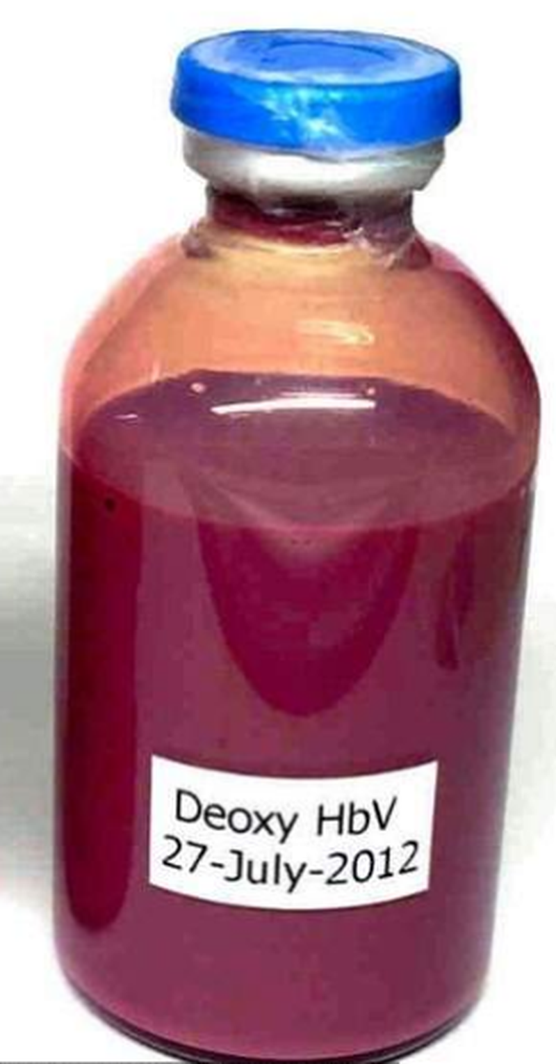 Informații de ultimă oră! A fost creat sângele artificial care poate fi tranfuzat pacienților, indierent de grupa sanguină