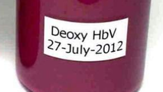 Informații de ultimă oră! A fost creat s&acirc;ngele artificial care poate fi tranfuzat pacienților, indierent de grupa sanguină