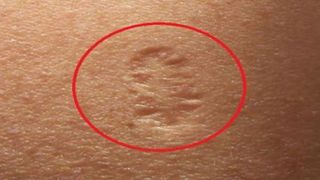 Ai și tu acest semn pe braţ? Uite care este adevărata lui semnificaţie