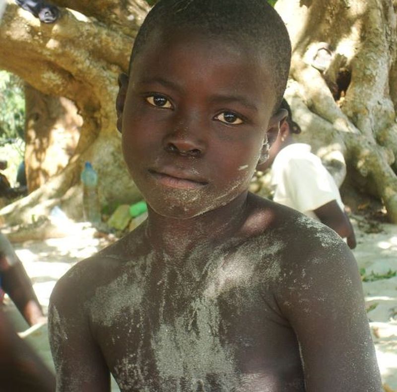 Semnal de alarmă pentru părinți. Unul din trei copii din lume este malnutrit sau supraponderal