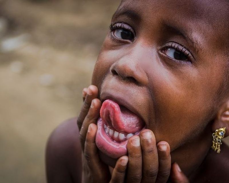 Semnal de alarmă pentru părinți. Unul din trei copii din lume este malnutrit sau supraponderal