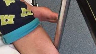 Cazul șocant al copilului alergic la iarnă. Ce reacție &icirc;i provoacă frigul