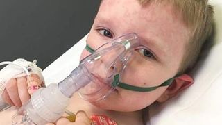 Cazul șocant al copilului alergic la iarnă. Ce reacție &icirc;i provoacă frigul