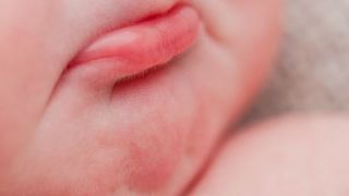 Caz terifiant-părinți &icirc;n stare de șoc, după ce bebelușul lor s-a născut fără ochi, nas și parte din craniu, &icirc;ntr-o clinică privată