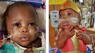 Minune dumnezeiască: după cinci luni de la naștere, fetița care este c&acirc;t o păpușă Barbie, părăsește spitalul