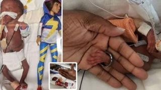 Miracol! C&acirc;nd s-a născut era c&acirc;t o păpușă Barbie, iar acum c&acirc;ntărește 7 kilograme! Cum arată &icirc;n prezent micuța Kallie Bender