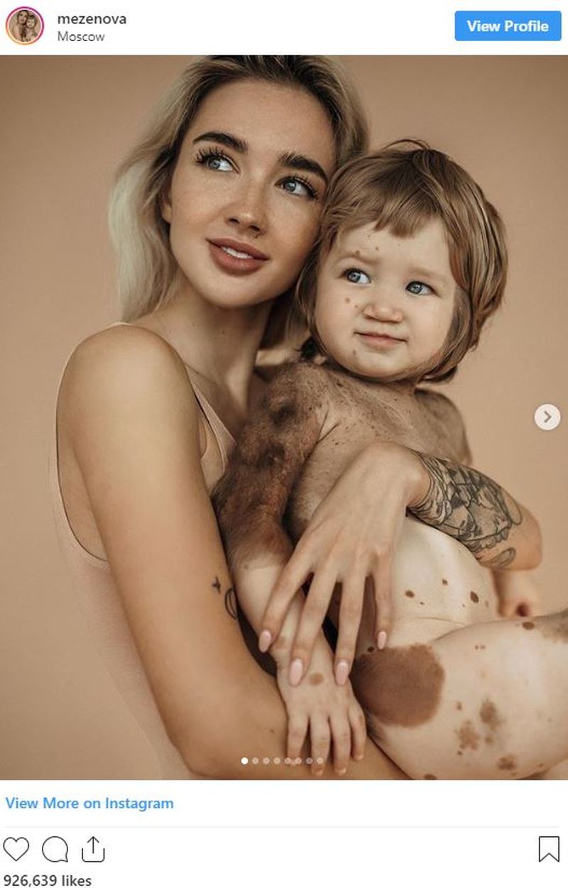 O renumită influenceriță, face detalii cutremurătoare despre boala rară cu care se confruntă fiul său