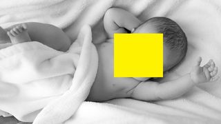 Bebelușul fără chip. Cazul medical care a șocat lumea