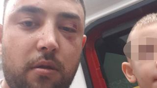 Scene șocante în care un copil de trei ani este gazat de agenţii unei firme de pază din Caracal. Tatăl este bătut în fața lui, pe stradă