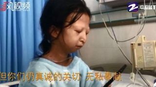 Cazul șocant al fetei care a făcut foamea timp de 5 ani, pentru fratele ei bolnav