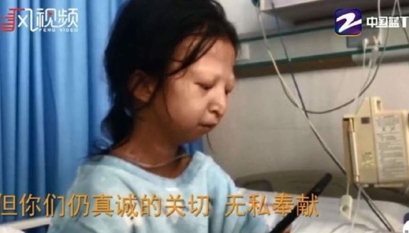 Cazul șocant al fetei care a făcut foamea timp de 5 ani, pentru fratele ei bolnav