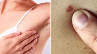 Nicio femeie nu va mai muri de cancer. Un simplu test &icirc;ți salvează viața