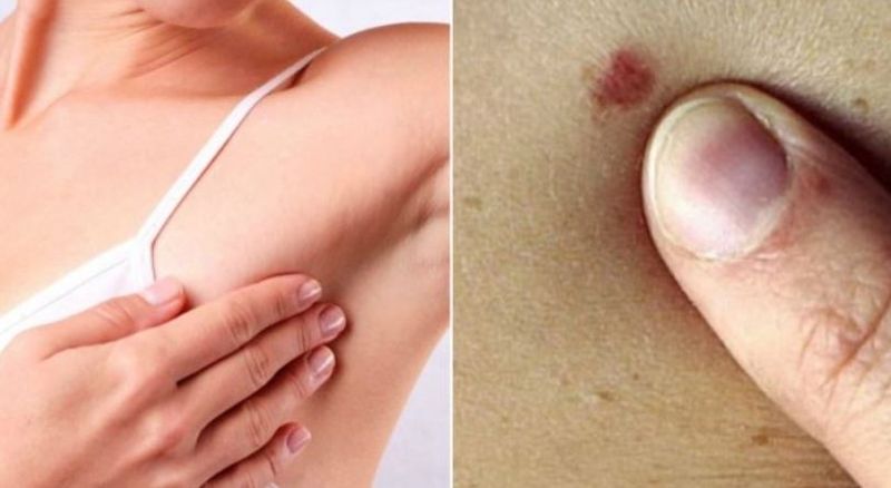 Nicio femeie nu va mai muri de cancer. Un simplu test îți salvează viața