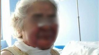 VIDEO | Nepotul bătrânei arse în spital, mărturisiri halucinante! A făcut publice imaginile cu chipul desfigurat al femeii