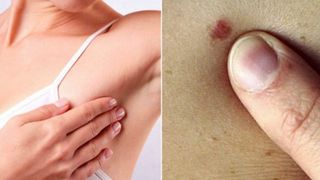 Simptomul care arată clar că ai cancer la s&acirc;n. Toate femeile &icirc;l ignoră!