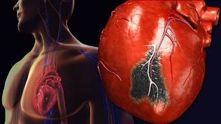 Cum să faci față unui atac de cord? Pașii esențiali care &icirc;ți pot salva viața