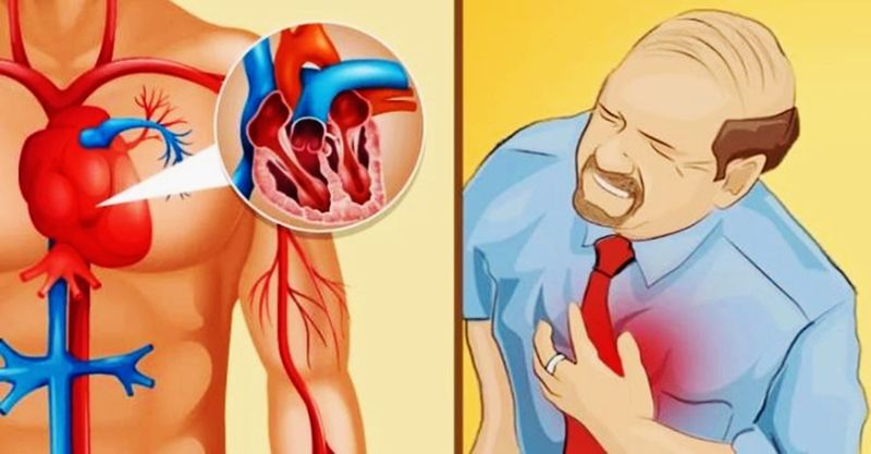 Cum să faci față unui atac de cord? Pași esențiali care îți pot salva viața