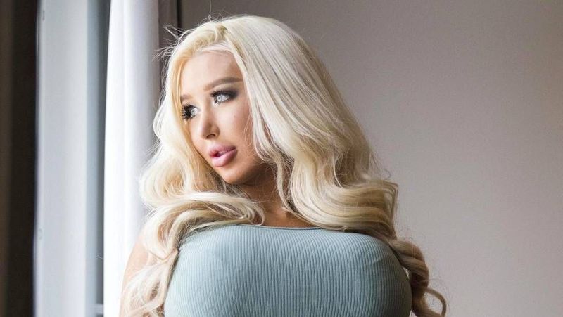 Tragedie! Un model celebru a murit la doar 32 de ani din cauza operațiilor estetice