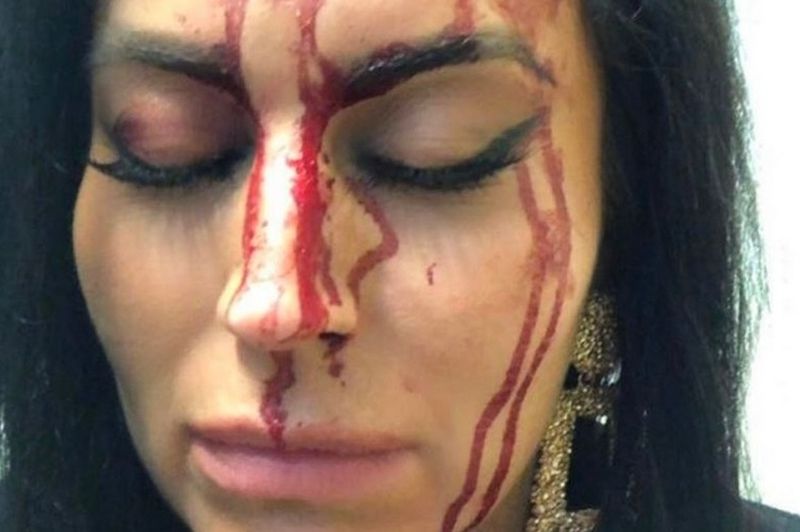 O prezentatoare TV a ajuns din clubul de noapte direct la spital, plină de sânge