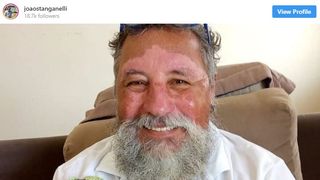 Gestul emoționant făcut de un bunic pentru nepoata lui. Deși suferă de o boală rară, omul se gândește la cei din jur mai mult decât la propria sa persoană