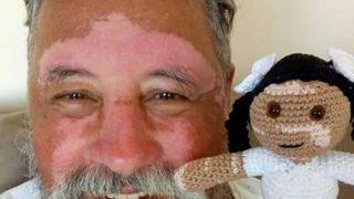 Gestul emoționant făcut de un bunic pentru nepoata lui. Deși suferă de o boală  rară se gândește și la cei din jur