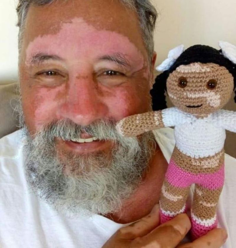 Gestul emoționant făcut de un bunic pentru nepoata lui. Deși suferă de o boală  rară se gândește și la cei din jur