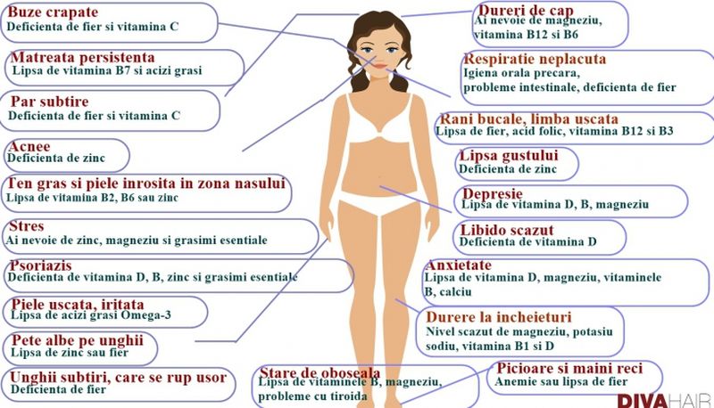 Carente de vitamine si minerale. Carente de vitamine si minerale simptome. Lipsa vitamine si minerale.  