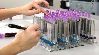 Test Babes  Papanicolau  Interpretare Papanicolau Celule scumoase Celule ASCUS Test Papanicolau Celule scuamoase Papanicolau