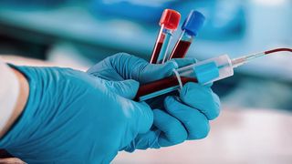 Bombă ecologică în România! Deputat USR:  Mii de litri de sânge contaminat şi alte deşeuri infecţioase, aruncate zilnic în sistemul de canalizare