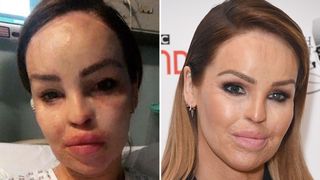 O celebră moderatoare TV a fost stropită cu acid sulfuric: &bdquo;Omor&acirc;ți-mă!&rdquo;