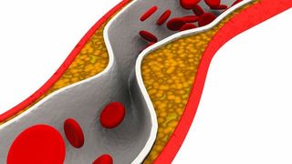 Trigliceride. Trigliceride serice. Ce sunt trigliceridele 