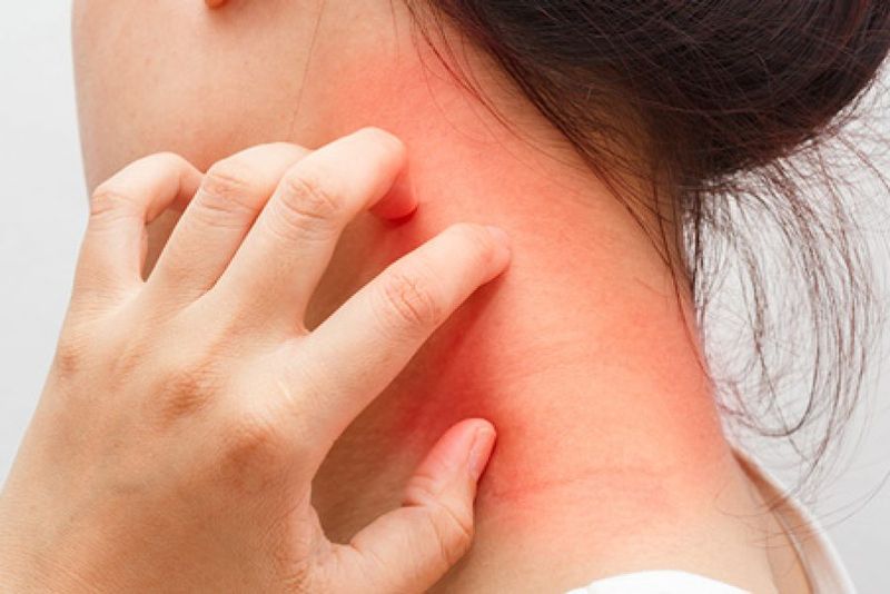 Dermatomiozita. Boala autoimuna dermatomiozita. Ce este dermatomiozita. Simptome dermatomiozita.