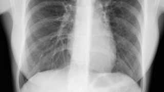 Ideea ingenioasă a unui t&acirc;năr din Timișoara: aplicația care citește radiografiile