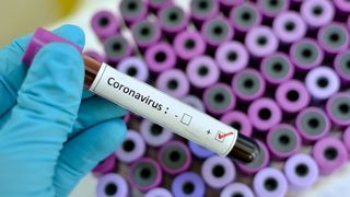 Alertă &icirc;n Italia! S-a &icirc;nregistrat, s&acirc;mbătă, al doilea deces cauzat de coronavirus