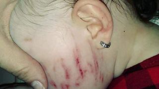 O fetiță a fost ținta copiilor la grădiniță